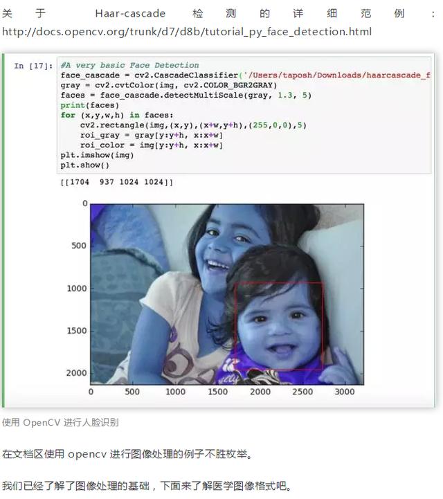 Python还能用于医学方面!这就亮瞎了我的钛合金人眼了!深度学习