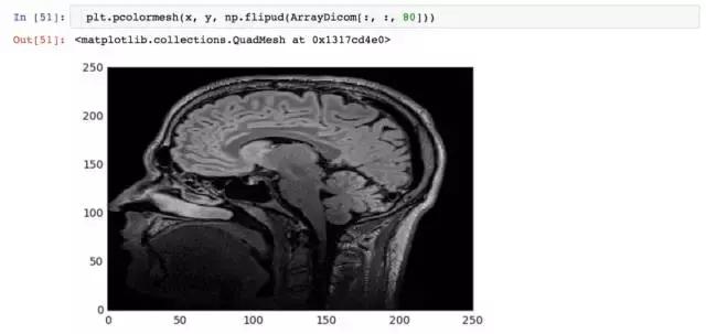 Python还能用于医学方面!这就亮瞎了我的钛合金人眼了!深度学习